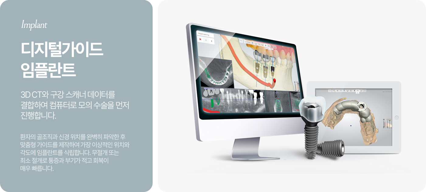 상악동 거상술