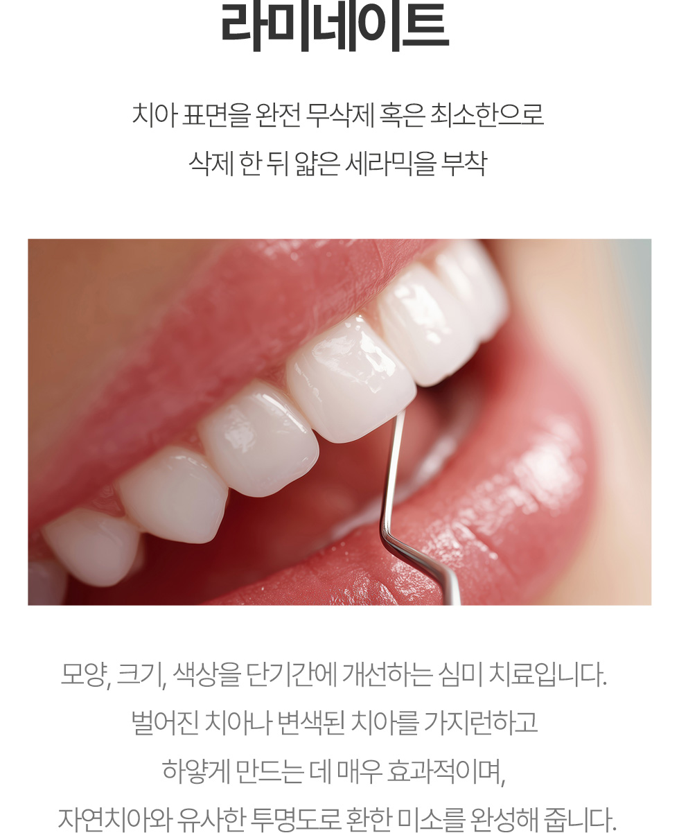 라미네이트