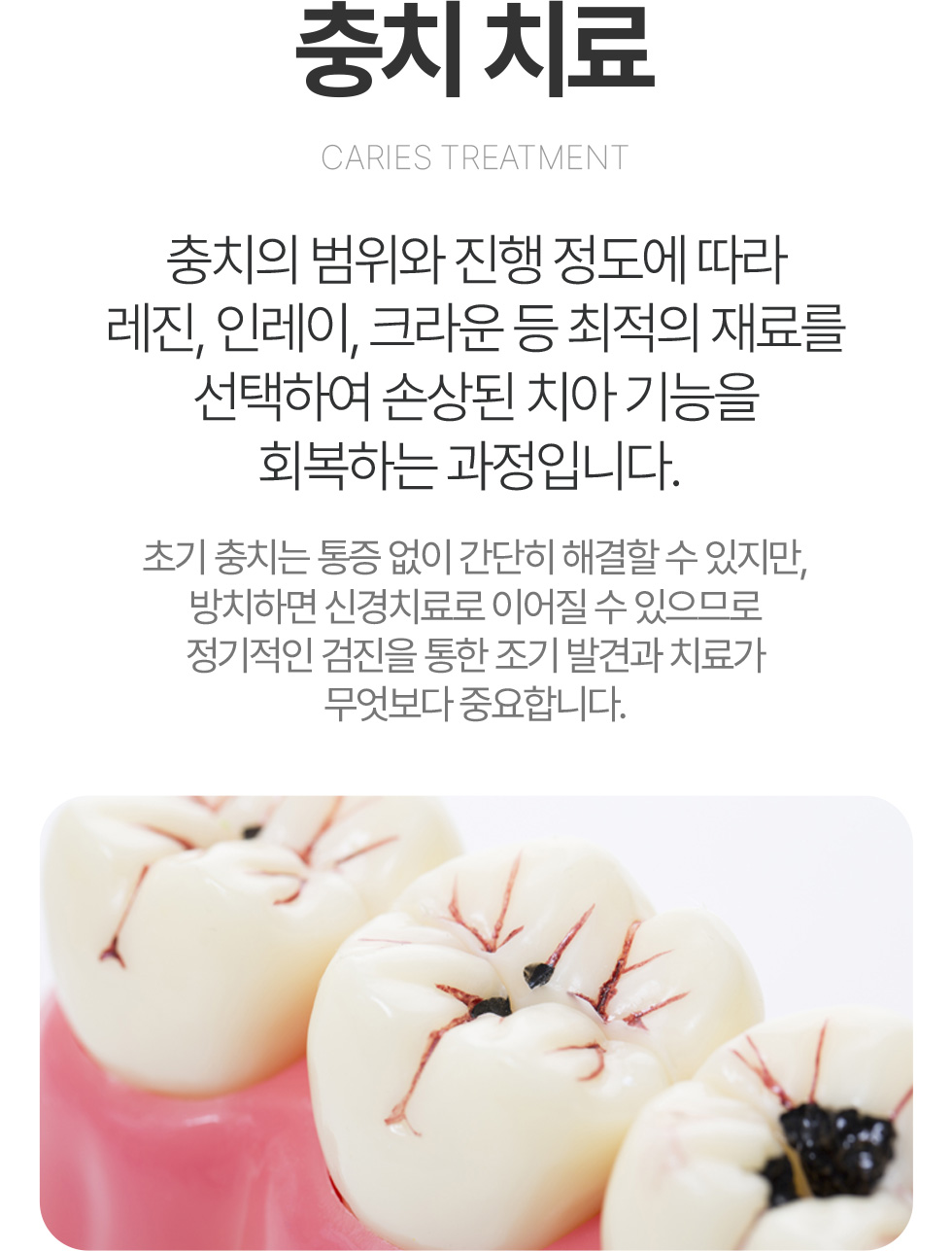 충치치료